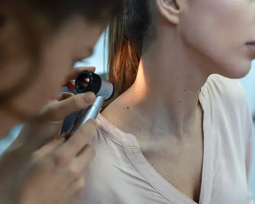 Dermatologo esamina neo sulla spalla di una paziente con dermatoscopio. Centro medico.