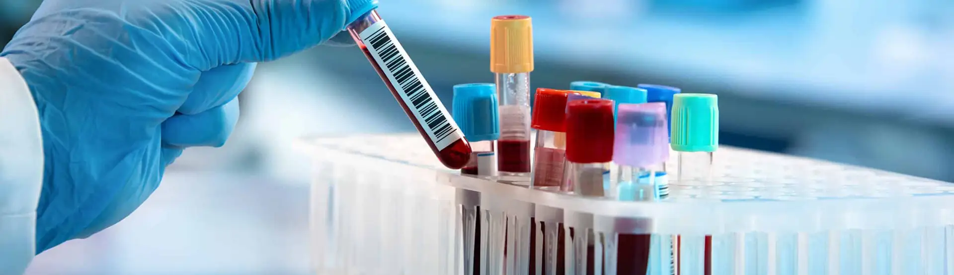 Prelievo di sangue: provetta con codice a barre in mano a un medico. Analisi di laboratorio.