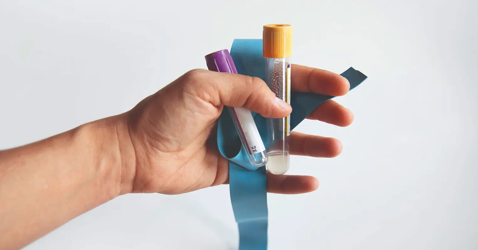 Mano che tiene provette di sangue con laccio emostatico. Analisi mediche in centro medico.